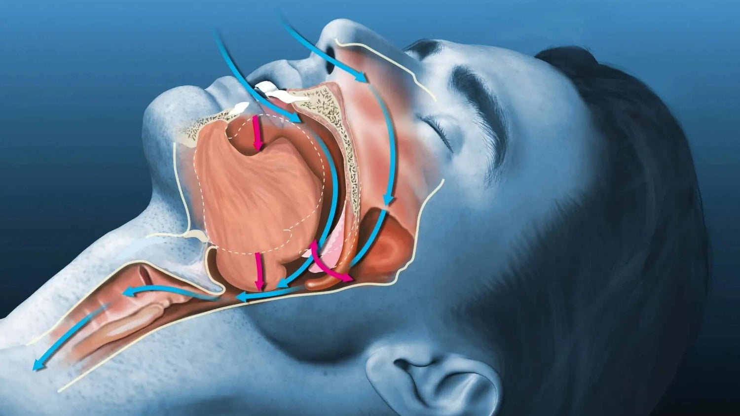 Apnée-du-Sommeil Santé Originelle